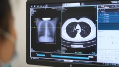 只需要告哪里不恬逸